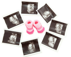 组 3d 4d 超声图像周围一双粉红色的宝宝引导