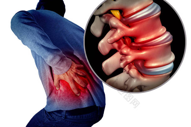 下背部疼痛或背痛和疼痛的脊椎医疗概念作为一个人持有疼痛的脊柱区域作为一个医学概念与3d 插图元素.