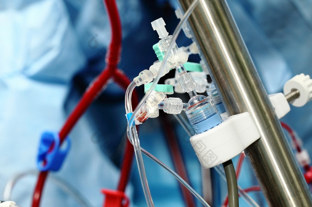 人工血液循环装置在重症监护病房