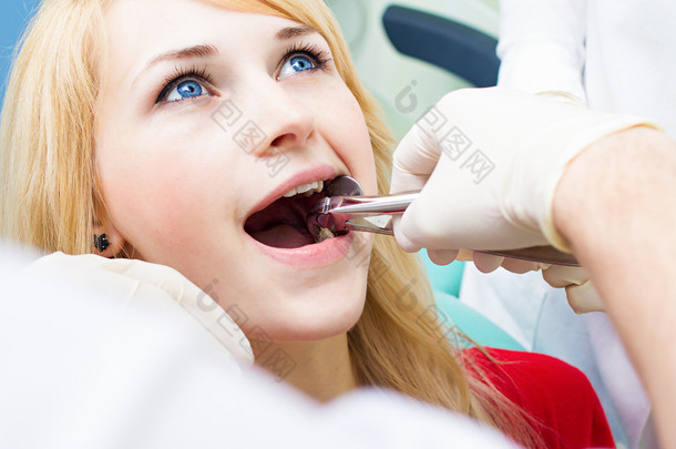 医生牙医用止血钳去除患者牙执行提取过程