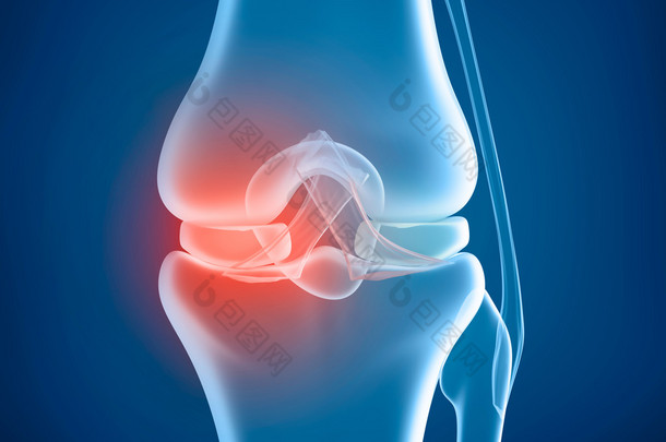 膝盖<strong>问题</strong>，x 射线视图