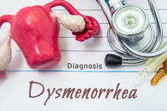 痛经的诊断。痛经诊断题字下听诊器、 子宫与卵巢图、 安瓿与医学患者的病历。治疗和诊断的概念