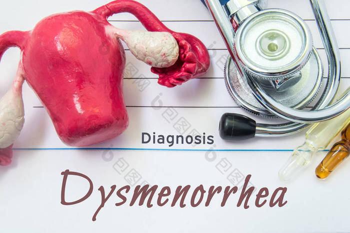 痛经的诊断。痛经诊断题字下听诊器、 子宫与卵巢图、 安瓿与医学患者的病历。治疗和诊断的概念