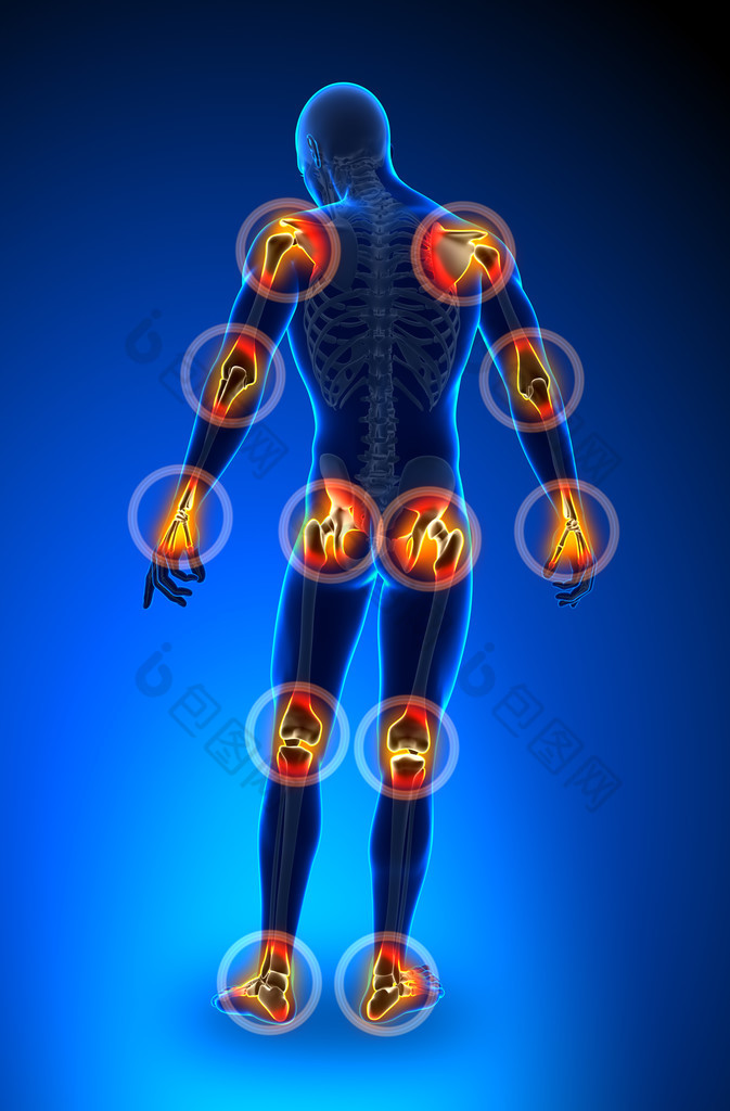 关节疼痛-全图
