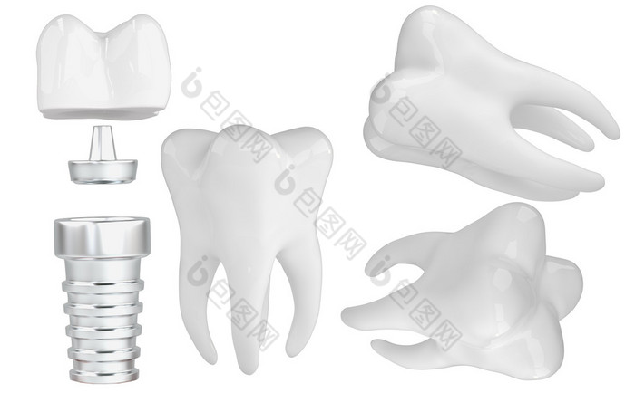 牙科修复组件中性灰白色假牙与根管植入物 种植牙