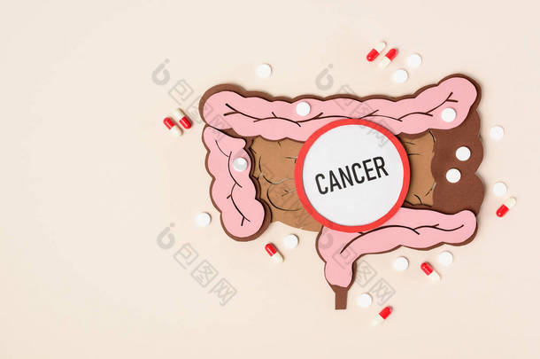人大肠, 各种<strong>药丸</strong>和刻字癌症在米色的顶部视图