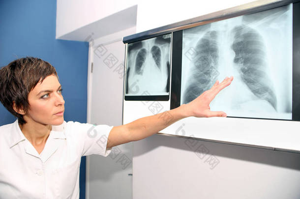 X 射线的肺，肺栓塞 （pe），肺动脉高压，C