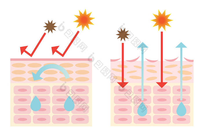 信息图皮肤插图。健康的皮肤和干燥的皮肤机制