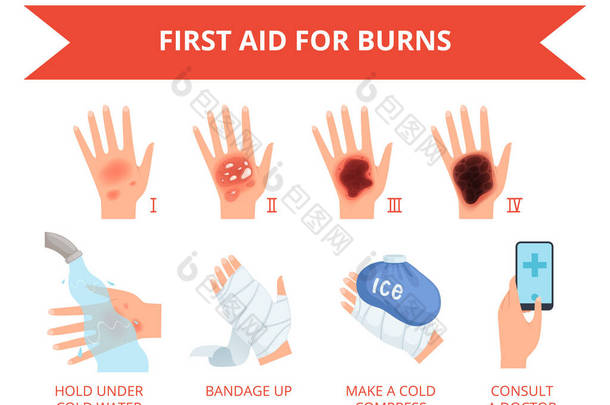 烧焦的皮肤。人体手火或化学毁坏损伤初治人皮肤重量安全信息图
