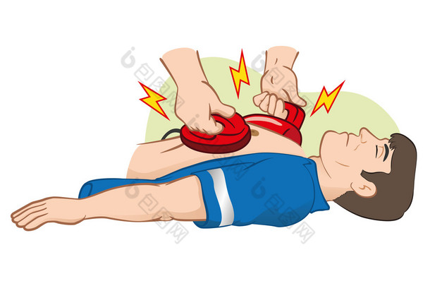 插图急救复苏 (Cpr) 使用除颤器对心脏骤停。理想的培训材料，编目和体制