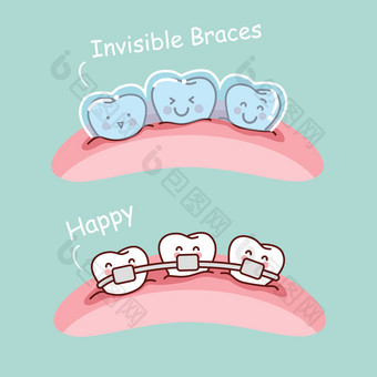 隐形牙套卡通牙图片