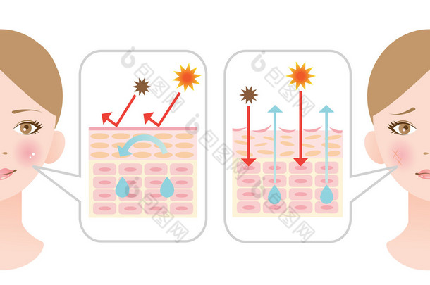 信息图皮肤插图。干燥的皮肤和健康的皮肤
