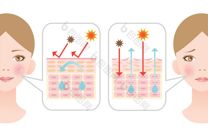 信息图皮肤插图。干燥的皮肤和健康的皮肤