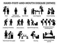 手足口病的口蹄疫图标。插图描述的迹象, 症状, 预防和行动的手足口病病毒感染儿童在学前, 学校和日托. 