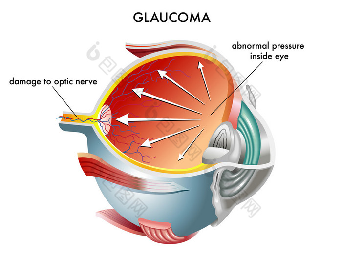 青光眼眼解剖