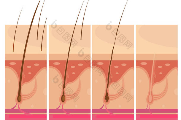 头发损失<strong>皮肤</strong>概念