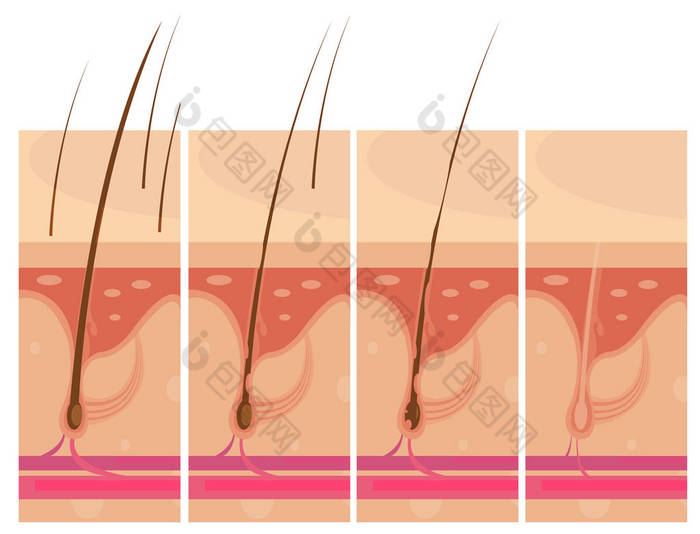 头发损失皮肤概念