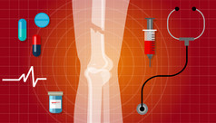 骨折断腿人体解剖学 x 射线医学治疗图图标