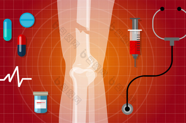 骨折<strong>断</strong>腿人体解剖学 x 射线医学治疗图图标