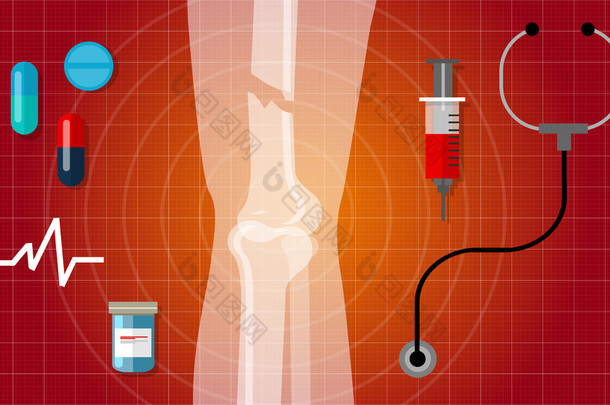 骨折断腿人体解剖学 x 射线医学治疗图图标