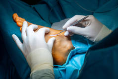 外科医生用手术刀在一只脚上开刀