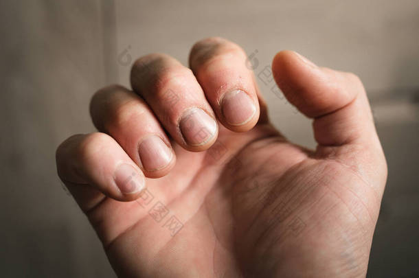 指甲被咬得脏兮兮的,没有形体,而且被人忽视的手部状况,修指甲是必要的
