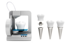 牙科技术概念。3d 打印机打印牙种植体 