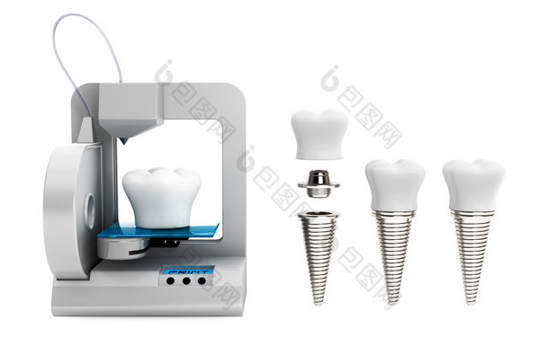 牙科技术概念。3d <strong>打印机</strong>打印牙种植体 