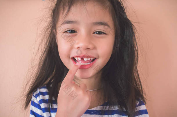 亚洲小女孩炫耀她丢失的门牙