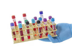 医生或实验室技术员手 holnding 一架血液样本测试管 laboaratory 在白色