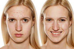 皮肤护理-美容治疗