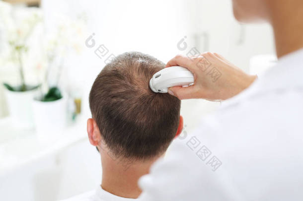 Trichological 考试。用显微镜检查头皮和头发时头发稀疏的男人的头