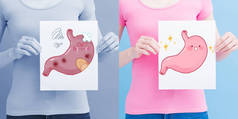 健康和不健康的胃广告牌。健康理念 