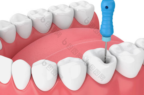 3d 渲染牙齿与牙髓文件在下巴
