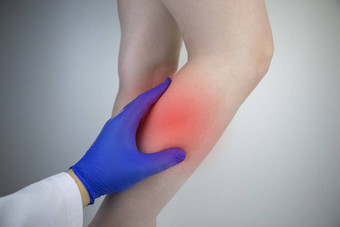 一个女人的小腿很疼.伸展小腿肌肉、静脉曲张、腿抽筋或肌炎。骨科医生检查病人图片