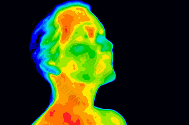 面对 Thermograpy 颈动脉