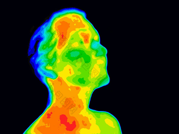 面对 Thermograpy 颈动脉