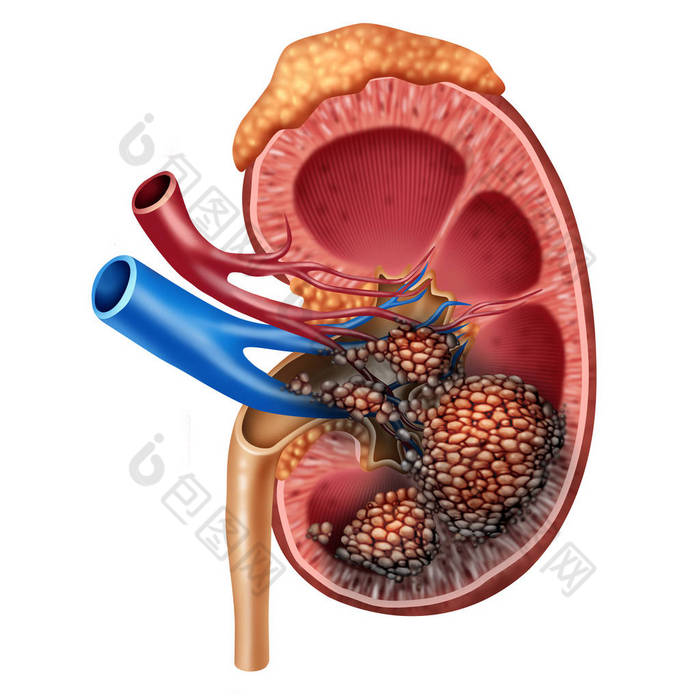 人类肾癌解剖学