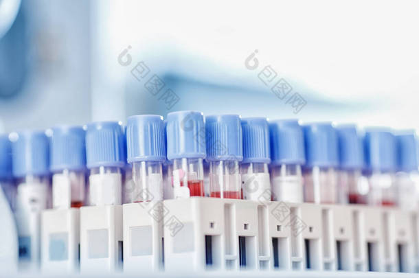 护士微生物学家拿着用于验血的验血试管对2019-nCoV进行分析