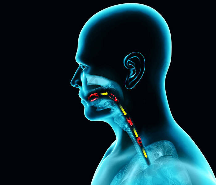 吞咽障碍，吞咽困难。 咽部和食管消化不良。 口述阶段。 食物的路径，吞咽的行为。 人通过X光，3D渲染。 吞咽涉及将唾液、固体食物和饮料从口中输送到胃里