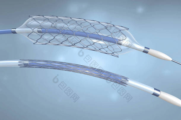 <strong>支架</strong>和导管植入血管与空和填充气球-3d 例证