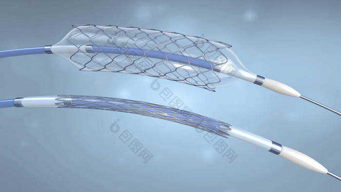 支架和导管植入血管与空和填充气球-3d 例证