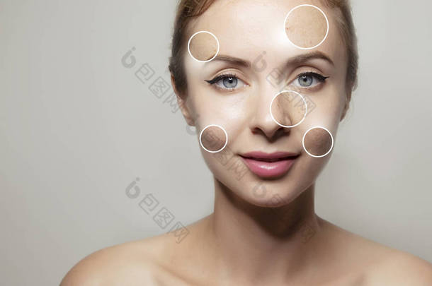 妇女脸肖像与清晰和粉刺的皮肤