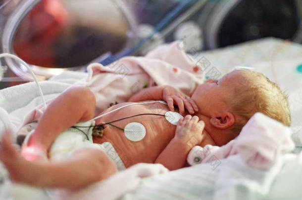 新生儿重症监护病房的孵化器中监测早产儿婴儿