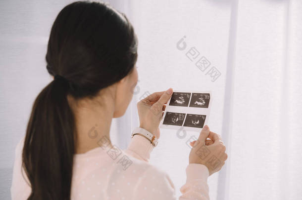 孕妇看超声诊断照片