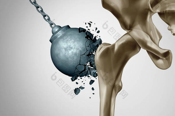 强骨和健康的人体骨整形术和强度的密度医疗概念作为一个<strong>破坏球破坏</strong>骨质疏松症预防医学作为3d 例证.