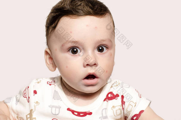 看惊讶相机可爱生病的婴儿男孩的肖像.