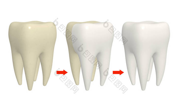 清洗牙齿的过程。人牙用不同的搪瓷颜色。在白色背景下被隔离。3d 渲染
