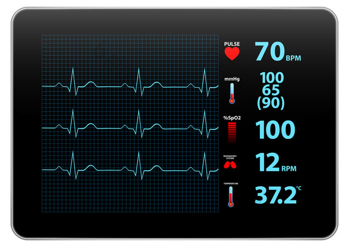 现代心电图监测设备显示血氧