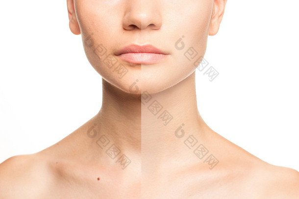 女人的脸，前后对比，动力润饰的美容概念